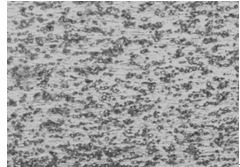 35鋼原材料球化退火態金相組織 400&times;